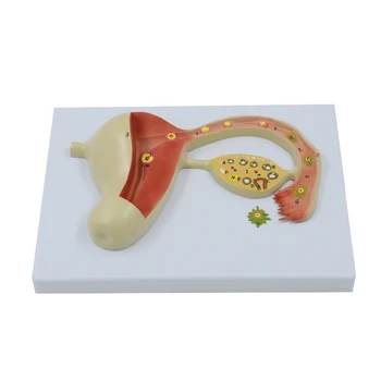 Ovar Anatomice Modelul Aparatului Genital Feminin Anatomia Uterului Model Educațional Echipamente Medicale Cadou Resurse Didactice